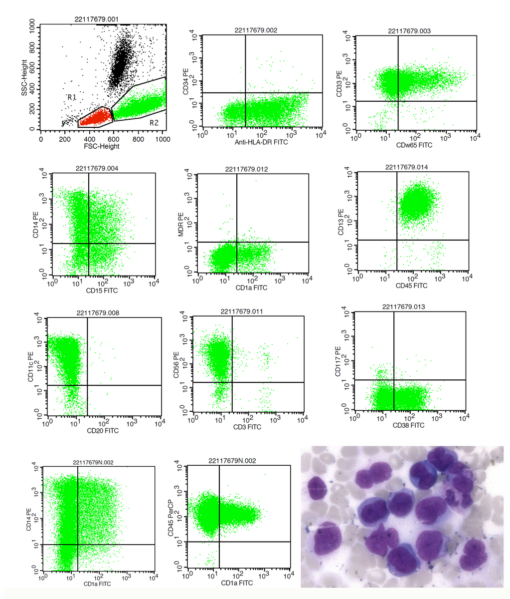Flow cytometric analysis of peripheral blood